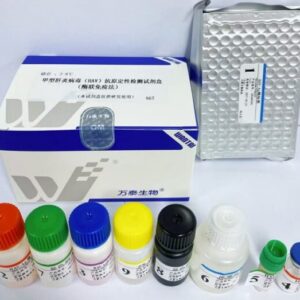 甲型肝炎病毒（HAV）抗体检测试剂盒（酶联免疫法）